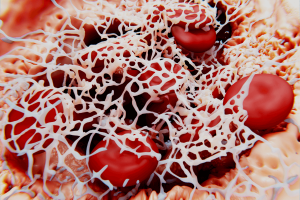 Beyond the Usual: SRA-Negative HIT Challenges in LVAD Therapy