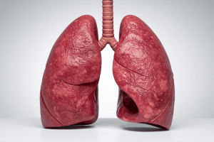 FDA Greenlights JASCAYD: First New IPF Treatment in Over 10 Years